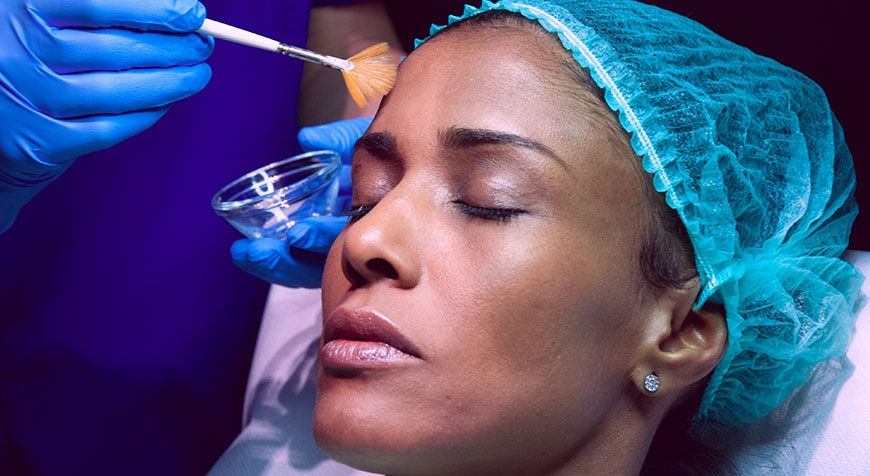 Eyes peel - Peeling occhi